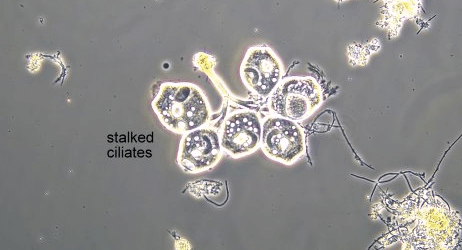 Stalked ciliates