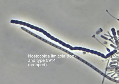 type 0914 and Nostocoida limicola